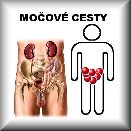 PLAVUŇ (D6)
